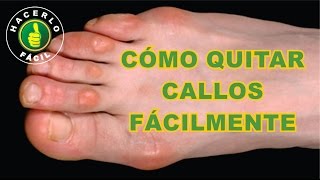 Cómo Quitar Callos de los Pies Fácilmente y Sin Dolor  Hacerlo Fácil [upl. by Faletti]