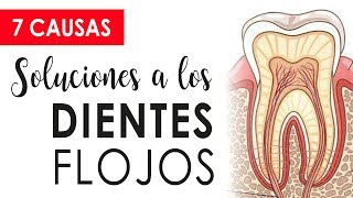 CUIDADO CON LOS DIENTES FLOJOS  CAUSAS Y SOLUCIONES 😱 [upl. by Hgielrak783]