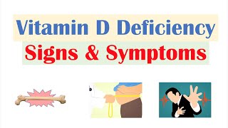 Vitamin D Deficiency Signs amp Symptoms ex Fatigue Diagnosis Treatment [upl. by Ttesil]