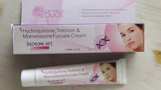 Elosone Ht Cream Benefit amp Hydroquinone amp Tretinoin amp Mometasone Cream Uses [upl. by Ealasaid]