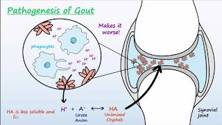 Gout  Mechanisms amp Treatment [upl. by Neelahtak]