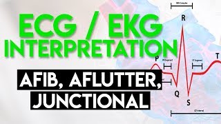 Afib Aflutter Junctional Arrhythmias  ECG EKG Interpretation Part 4 [upl. by Ahsenrat981]