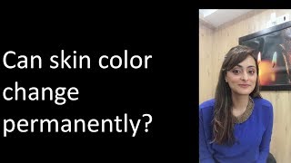 Can your skin tone change from dusky to fair  Dr Aanchal [upl. by Ellehcear]