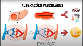 Inflamação Aguda [upl. by Gunning]