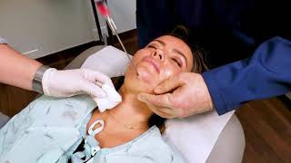 In Office Chin Liposuction [upl. by Ggerc]