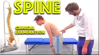 Spine Examination  Back Pain Assessment  4K  Clinical Skills  Dr Gill [upl. by Latsryk]