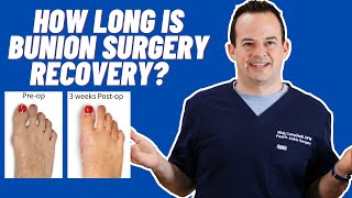 HOW LONG DOES BUNION SURGERY RECOVERY TAKE [upl. by Eiramaliehs]