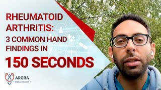 Rheumatoid Arthritis 3 Common Hand Findings in 150 seconds [upl. by Anifad]