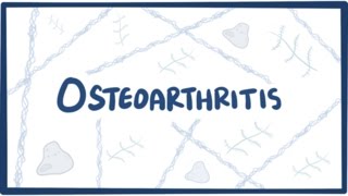 Osteoarthritis  causes symptoms diagnosis treatment amp pathology [upl. by Acenahs434]