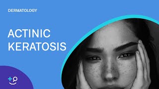 Actinic Keratosis Dermatology [upl. by Elletnohs389]