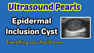 How I do it Ultrasound of the Abdomen [upl. by Rhiamon]