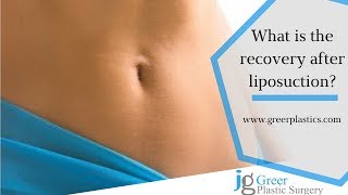 How long will you need off work after lipo [upl. by Einapets]