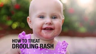 How to treat Drooling Rash [upl. by Boys]