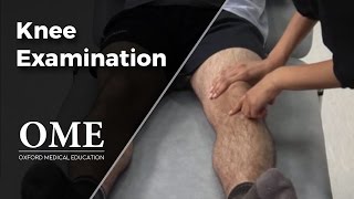 Knee Examination  Orthopaedics [upl. by Rochus]