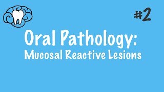 Oral Pathology  Mucosal Reactive Lesions  INBDE ADAT [upl. by Ueih]