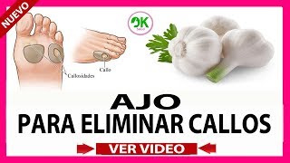 COMO QUITAR LOS CALLOS DELOS PIES  CÓMO ELIMINAR LOS CALLOS CON AJO [upl. by Elvie]