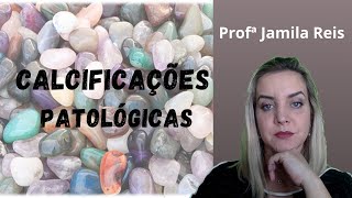 Calcificações patológicas [upl. by Nylanna139]